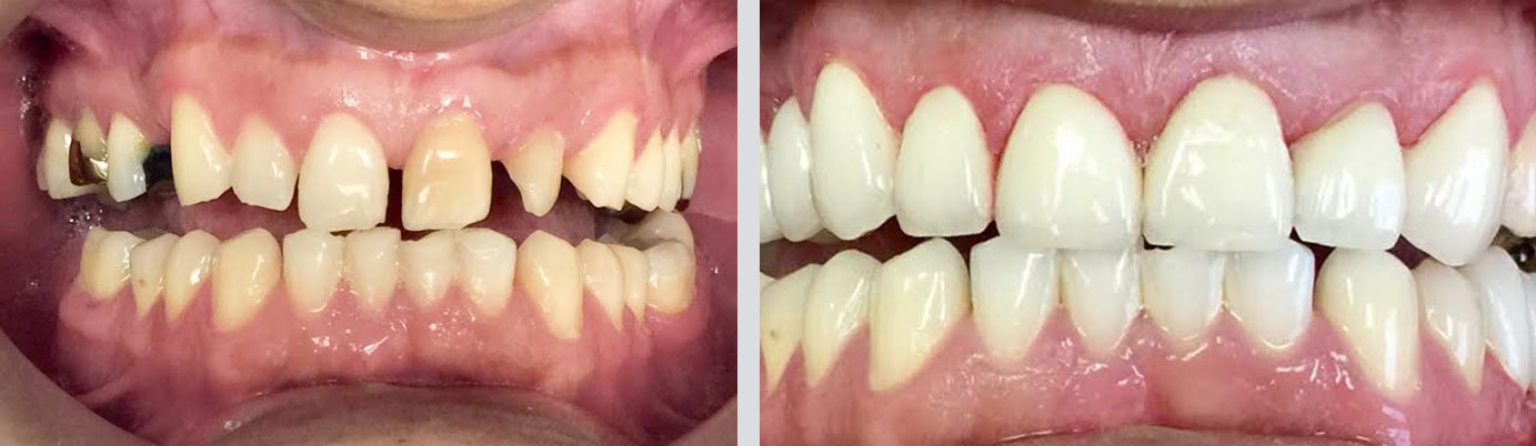 case 3 before and after Canton, MA